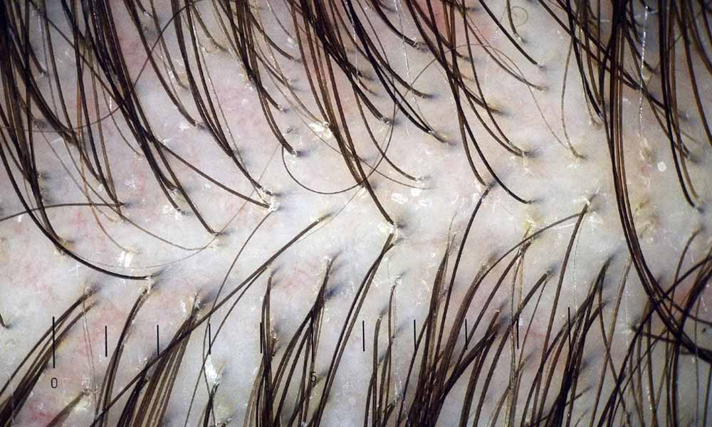 Bed bugs are attracted to the human scalp