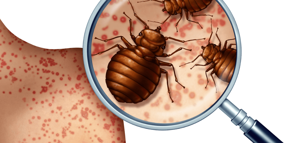 Bed Bug Fumigation - Understanding Bed Bug Infestations